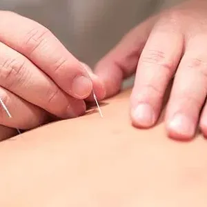 grandmadisonacupuncture