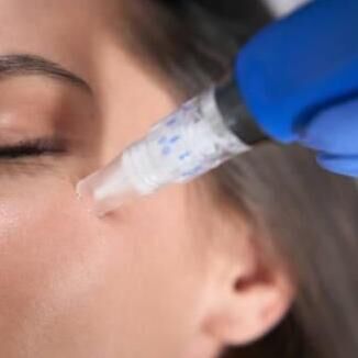 dermapen